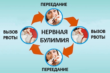 Лечение булимии в Газимурском Заводе